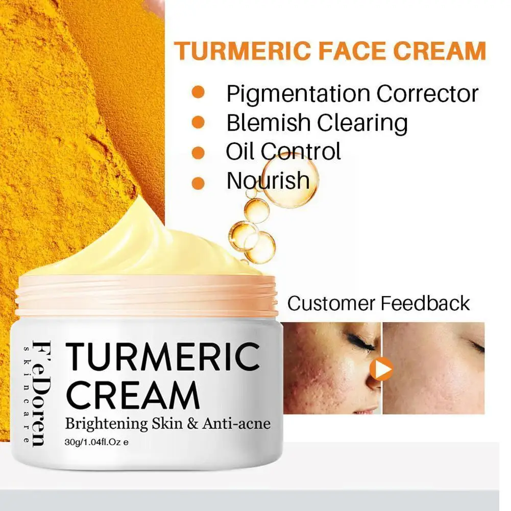 

30ml Turmeric Face Cream Repair Acnes Scar Dark Spot Against Moisturizer Skin Whitening Treatment Product Acne Care Lighten X0f1