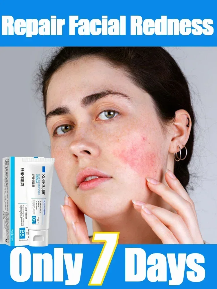 Мгновенный крем для восстановления красных точек на лице Успокаивающий Крем