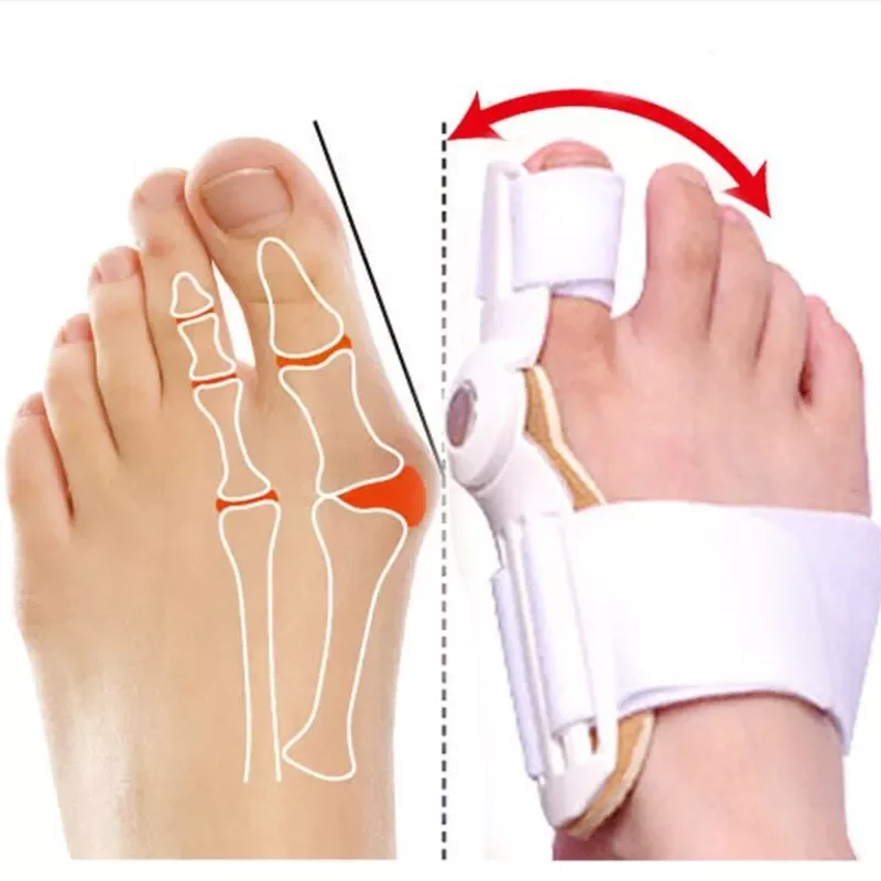 

Выпрямитель для большого пальца ног, Корректор боли в ступнях, при вальгусной деформации, ортопедические принадлежности, педикюр, уход за н...