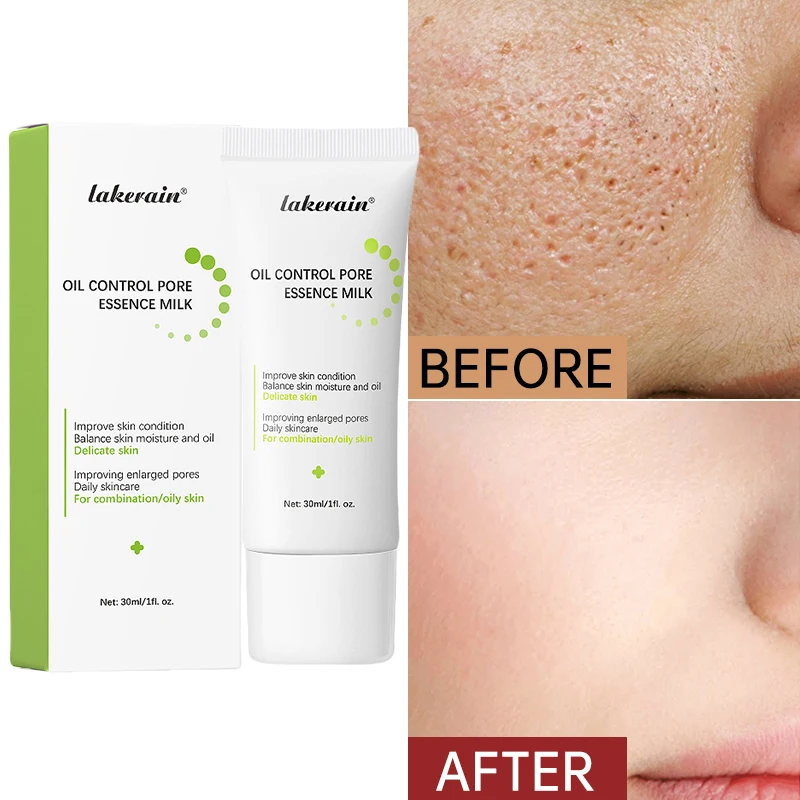 Крем для сужения пор с салициловой кислотой уменьшение больших подтяжка