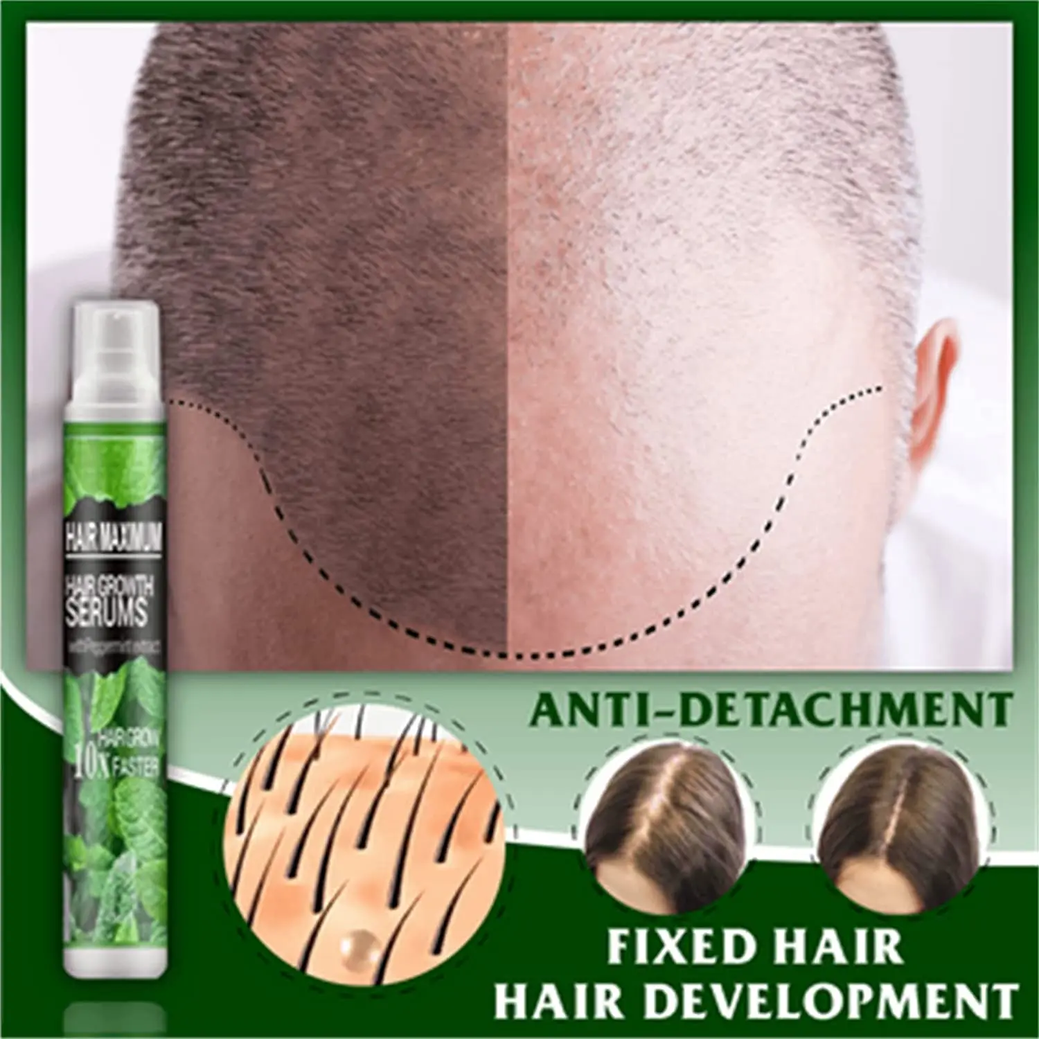 

HairReBirth Herbal Spray, HerbalRevive Hair-Growth Essence Spray, Herbal Hair Growth Maximizer Spray Fast Grow Treatments Spray