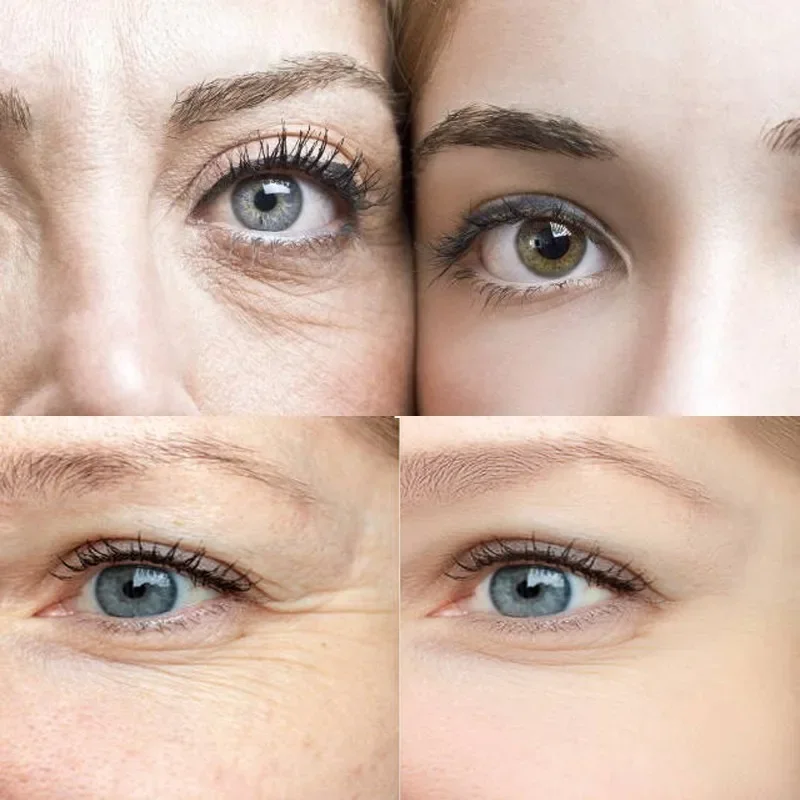 Рисунок 4 - набор увлажняющих антивозрастных