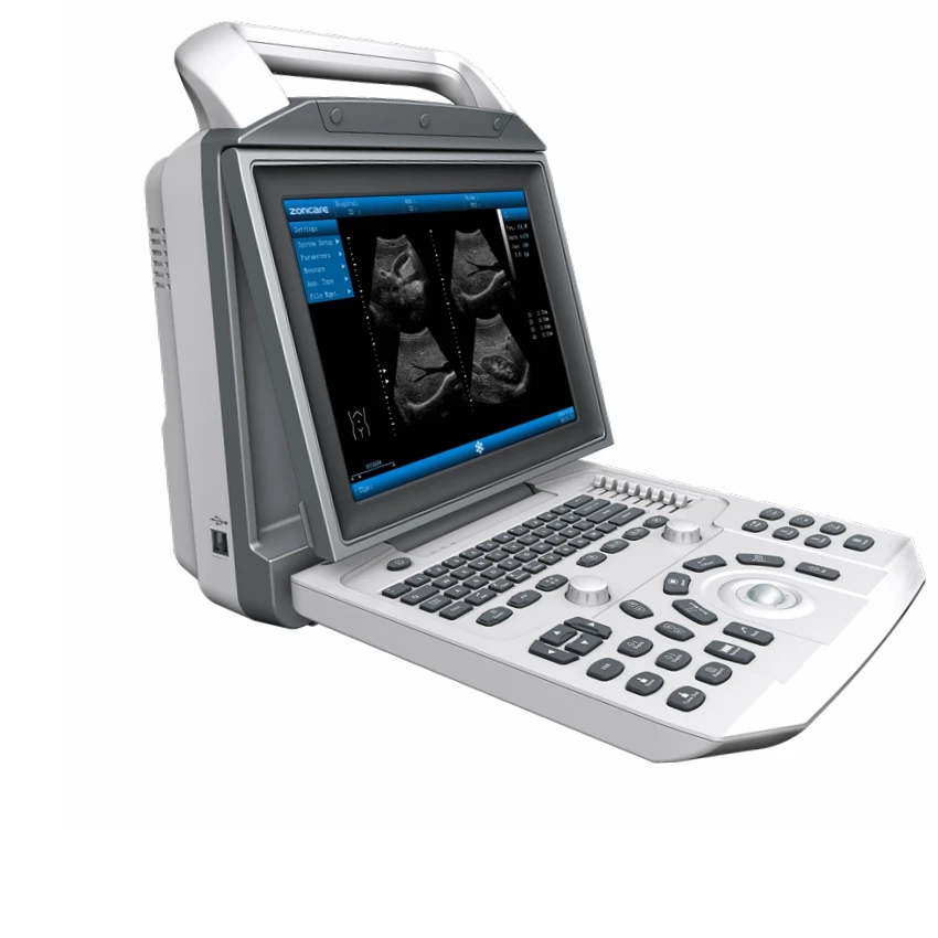 

Portable Ultrasound Ultrasonic Diagnostic System All Digital B/W Ultrasound System with High Quality