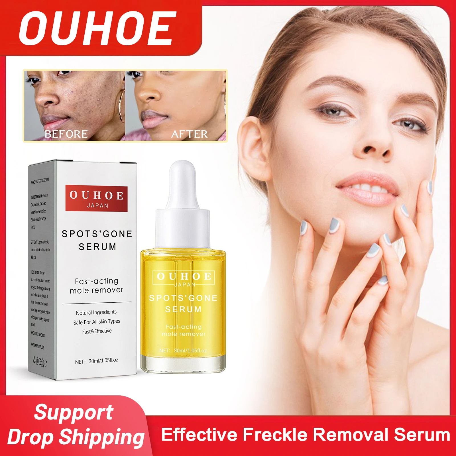 

Dark Spot Correcting Glow Serum Remove Melasma Melanin Pigment Whitening Rejuvenate Skin Anti Aging Freckle Remover Essence 30ml