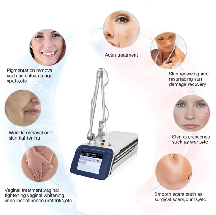 

Фракционный co2 Лазерный Аппарат RF для рубцов, фракционный Co2 лазер, удаление окрашивания влагалища, лифтинг лица, поверхность кожи