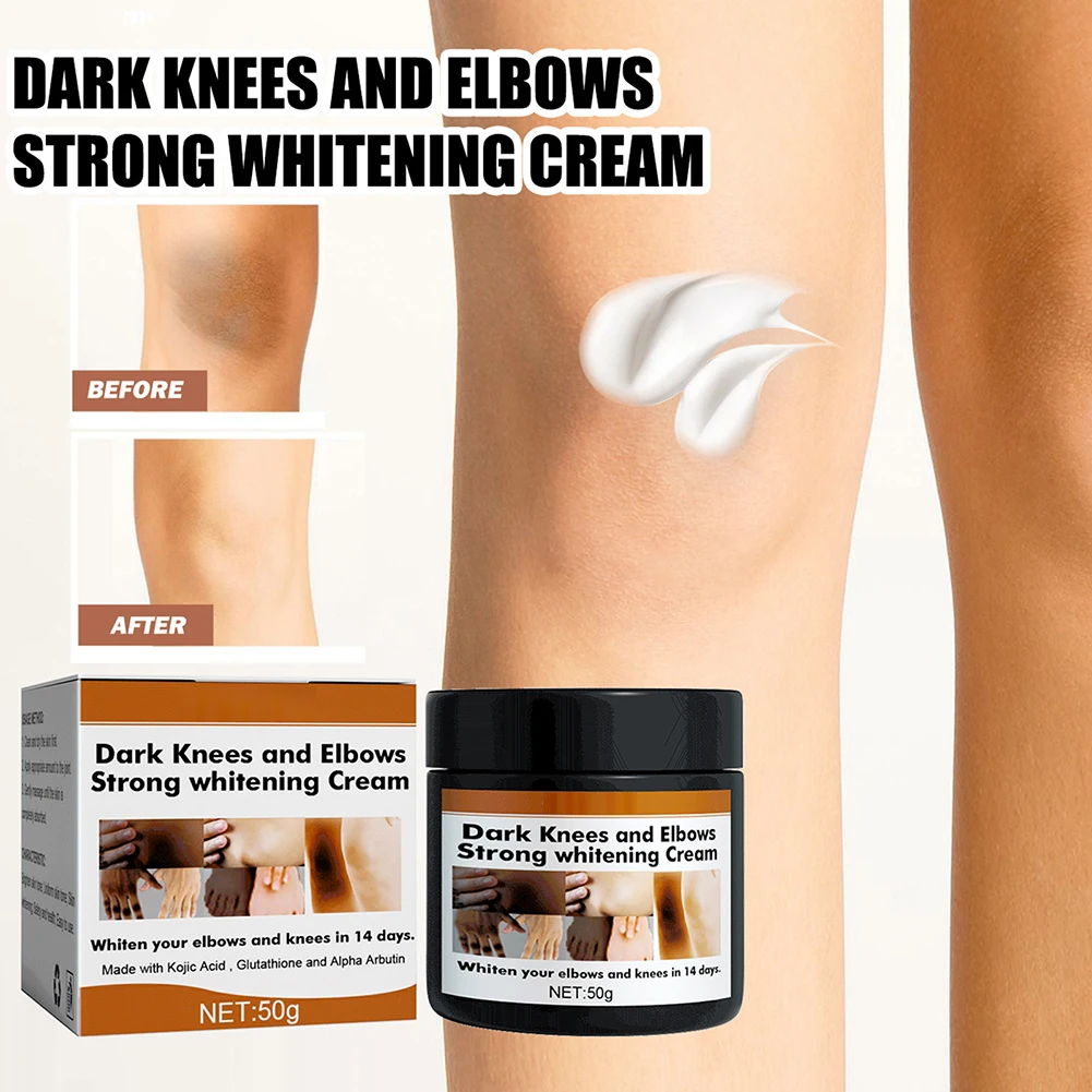 

Sdotter 50ml Whitening Cream For Dark Skin Remove Melanin Dull Moisturizing Brighten Body Skin Care For Neck Armpit Strong White