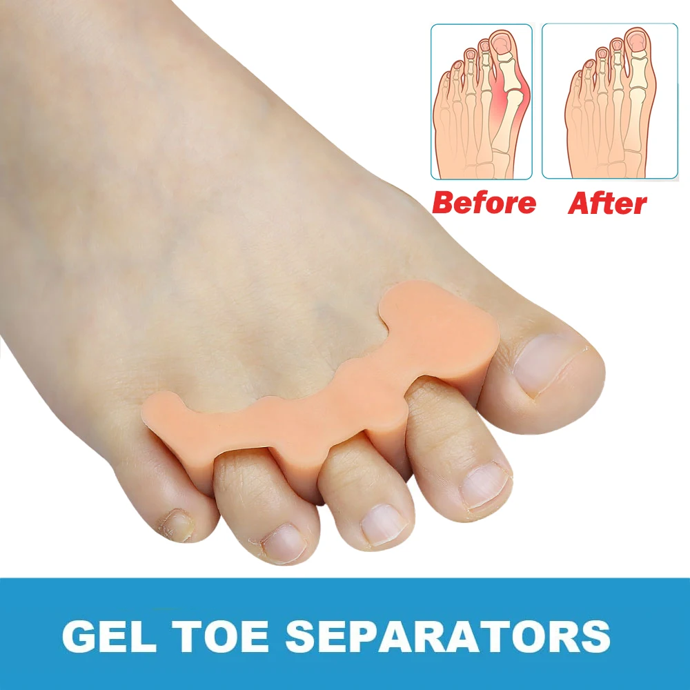 Рисунок 4 - разделители для пальцев ног для