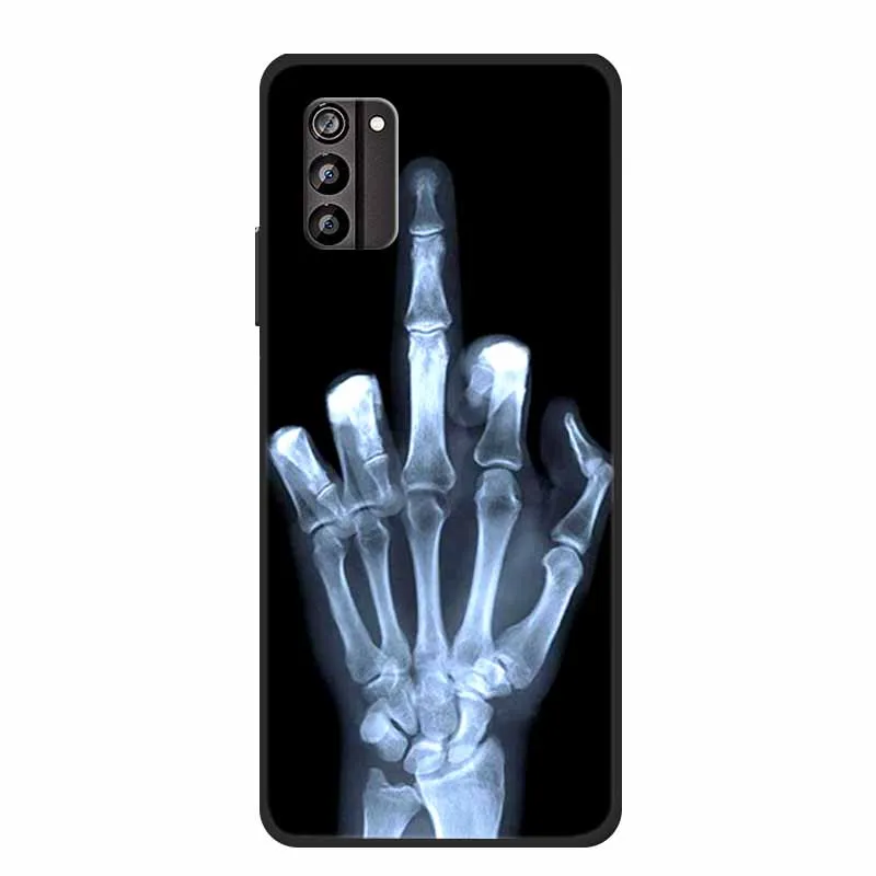 Чехол для Nokia G100 Мягкая силиконовая задняя крышка с животными из ТПУ чехлы