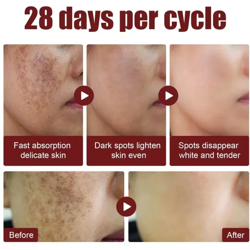 Niacinamide мелазма Осветляющий крем уменьшает меланин осветляет темную кожу хлоазма