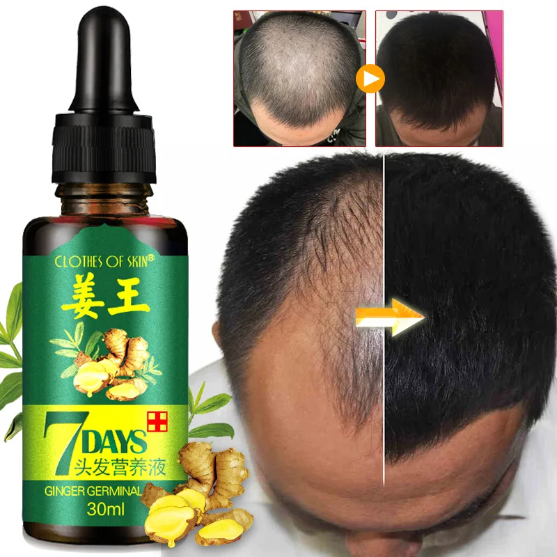 

Fast Hair Growth Serum Essential Oils Ginger Treatment Hair Loss Essence 7 Days Nourishing Soften Scalp Repair Damaged Hair Care