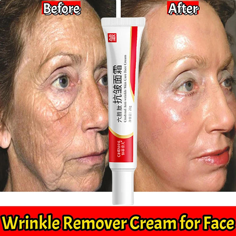 Полипептидный крем для удаления морщин лифтинг лица укрепляющий антивозрастной