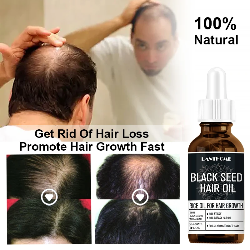 Black Seed Hair Oil Ginger Hair Growth Products Prevent Hair Loss Oil Fast Growing Beauty Hair Care Treatment For Men Women
