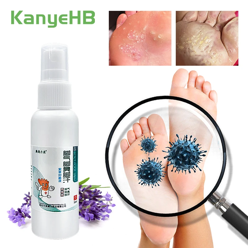 

1pc Anti Fungal Beriberi Foot Spray Remove Foot Odor Beriberi Itching Foot Care Chinese Herbal Medicine Foot Ointment S062