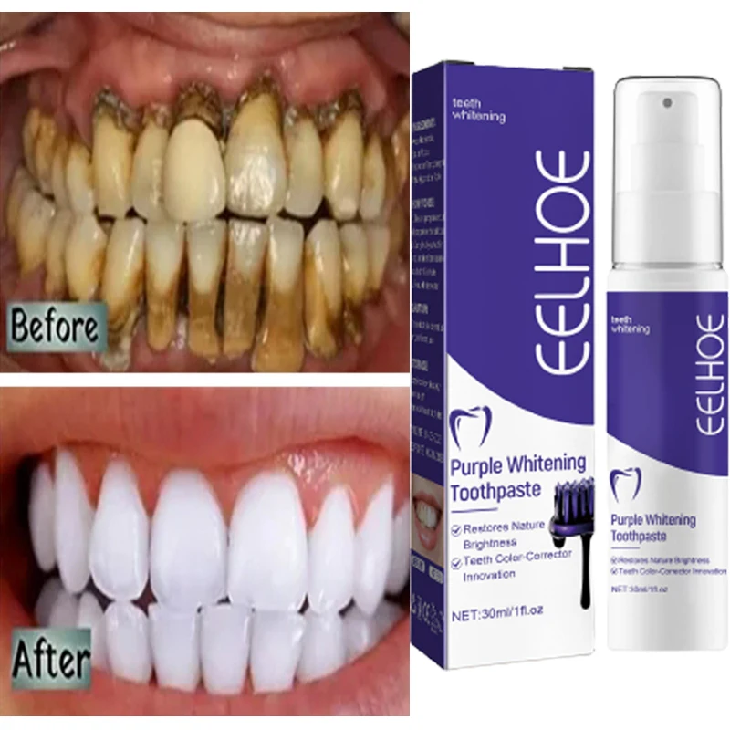 

Teeth Cleansing Whitening Toothpaste Whiten Gel Whitener Bleach Removes Stains Fresh Breath Tooth Cleaning Korean Care Products