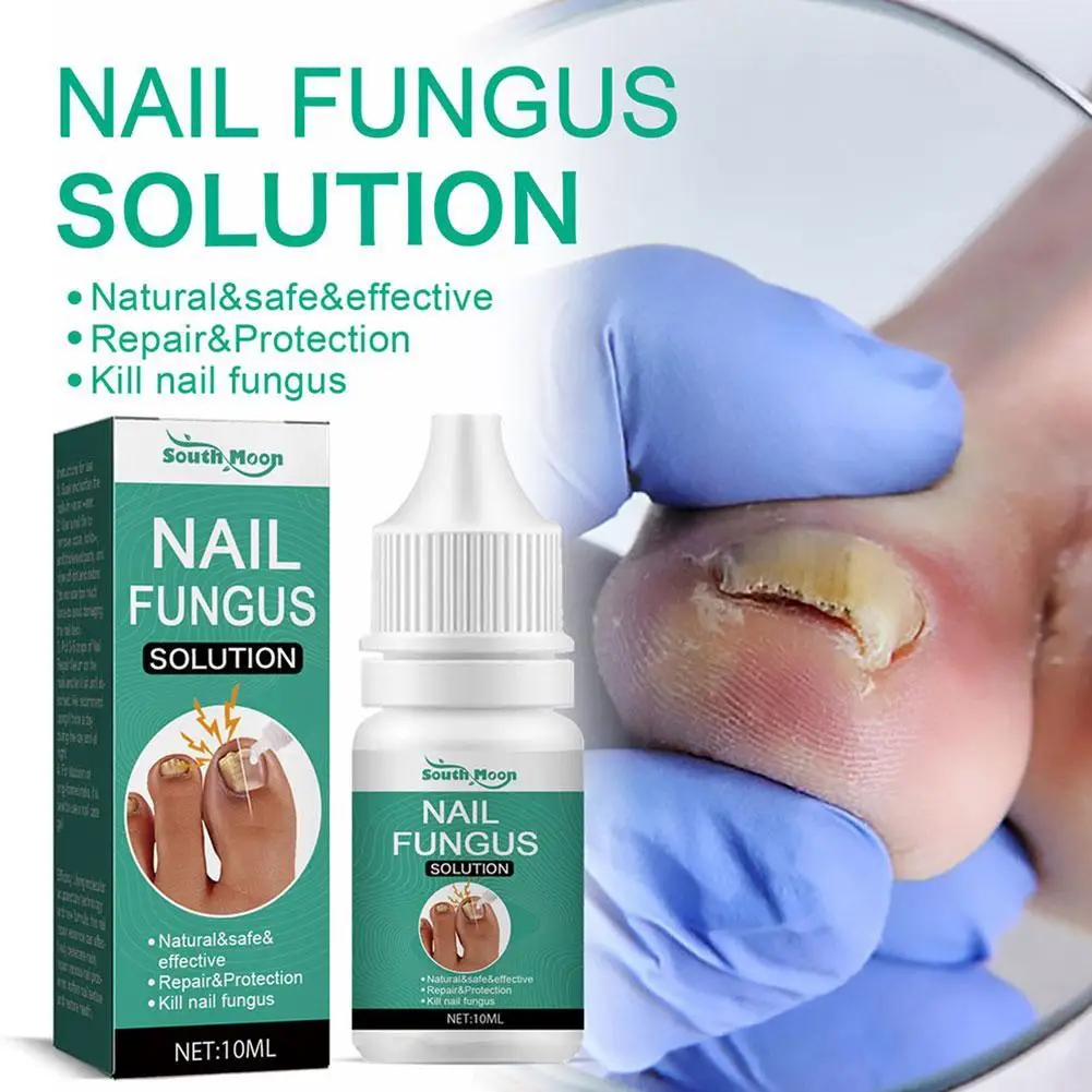 

10ml Nail Fungus Treatment Serum Essence Extra Strong Repair Feet Nails Onychocryptosis Anti Infection Toe Fungal Removal Care