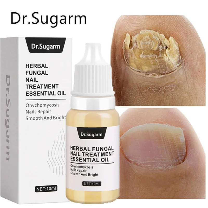 

Dr.Sugarm Nail Fungal Treatment Feet Care Essence Anti Infection Fungus Foot Toe Paronychia Onychomycosis Removal Gel Products