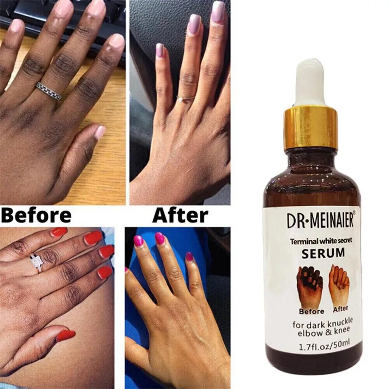

Powerful Removal of Dark Melanin Essence for Finger Joints Brightening Knees Armpits Ankles Skin Moisturizing Whitening Care50ml