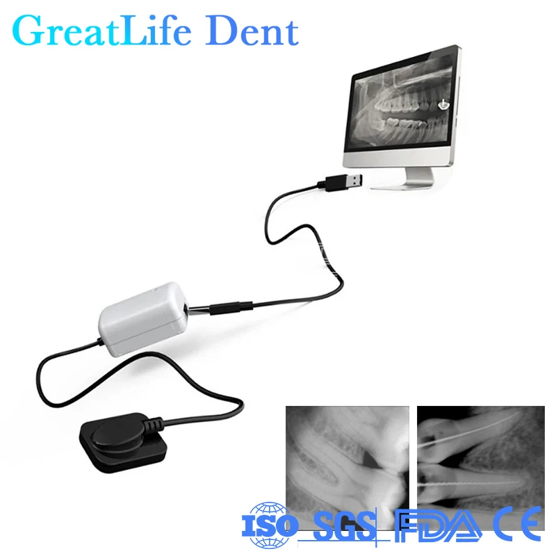 

GreatLife дешевый стоматологический рентгеновский Датчик Usb, датчик рентгеновского рентгена, стоматологический датчик рентгеновского рентгена