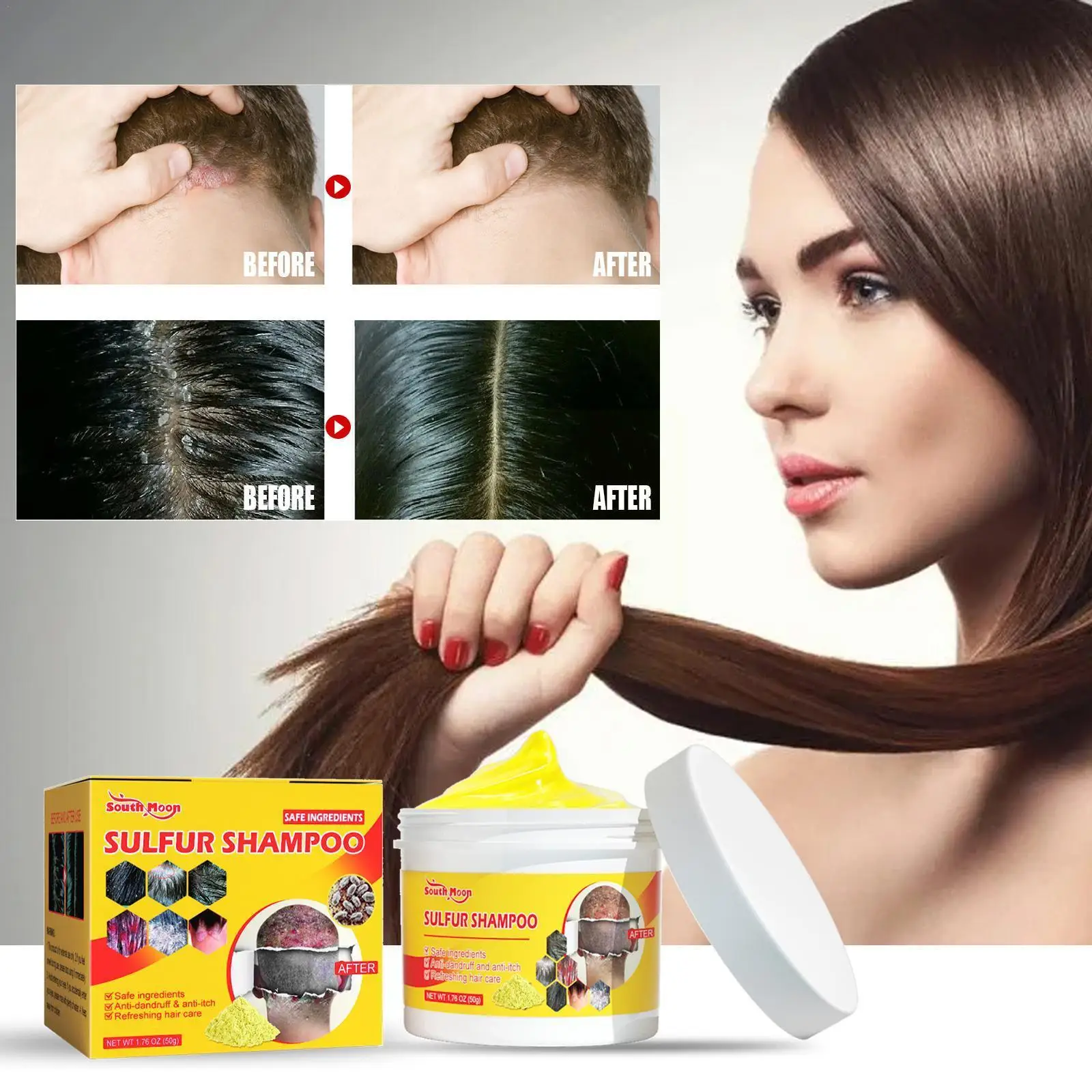 

Sulfur Shampoo Remove Lice Mites Dandruff Itching Oil Antipruritic Control Deep Scalp Nourishing Hair Care Cleaning Follicl J2K6