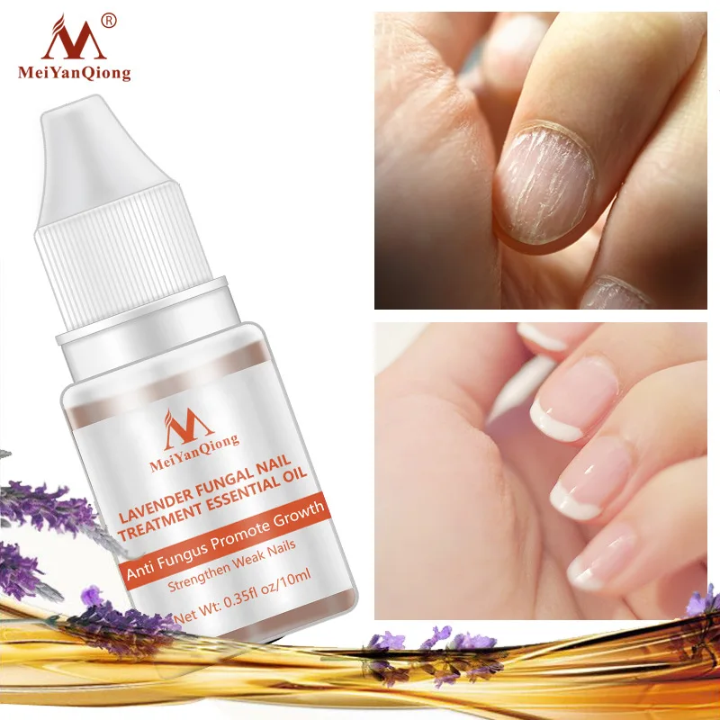 

Fungal Nail Treatment Serum Onychomycosis Paronychia Anti-Fungal Nail Infection Herbal Toe Fungus Foot Repair Essence Care 10ml