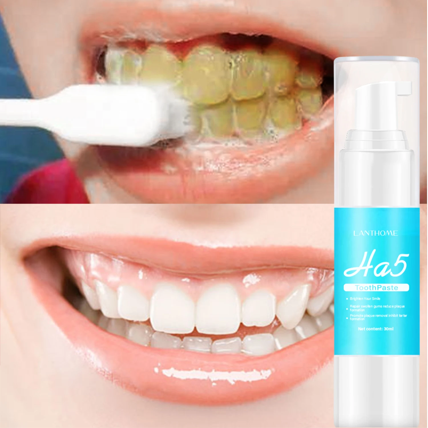 

Sdotter Original Lanthome Teeth Cleaning HA5 Toothpaste Stain Removal Whitening Booster Teeth Care Cleansing Brightness For Men