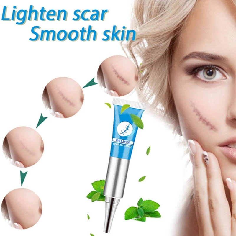 

20g Face Scarless Cream Scar Marks Removal Repair Acne Treatment Spots Whitening Regeneration Enhance Elasticity Pimples Health