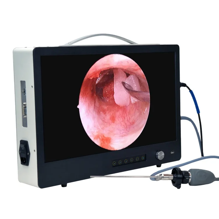 

22INCH 1920*1080p Full HD endoscope camera for laparoscopy