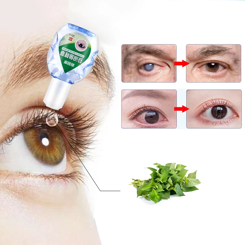 12 мл высококачественные лечебные капли для глаз лечения катаракты Прохладный