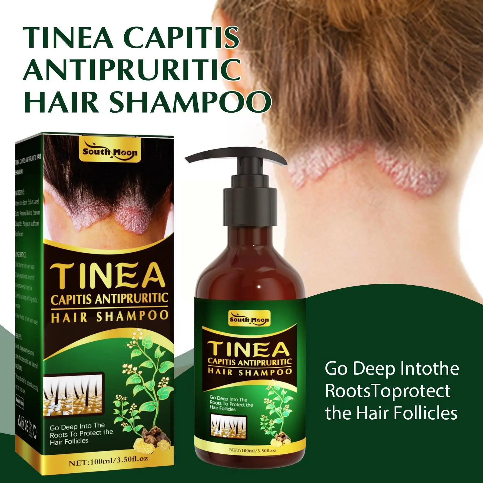 Scalp Seborrheic Hair Shampoo Treatment Dermatitis Head Eczema Cream Repair Dandruff Washing Hair Pruritus Acne Remove J0U8