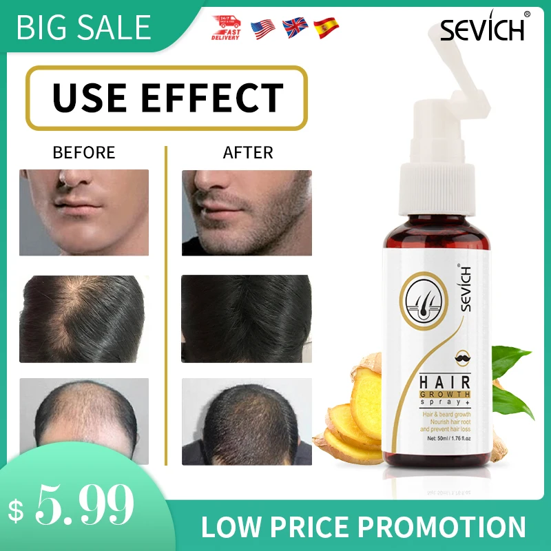 

Sevich Ginger Hair Growth Spray 50ml Preventing Hair Loss Serum Repair Grey White Hair Essential Oil Hair Loss Product