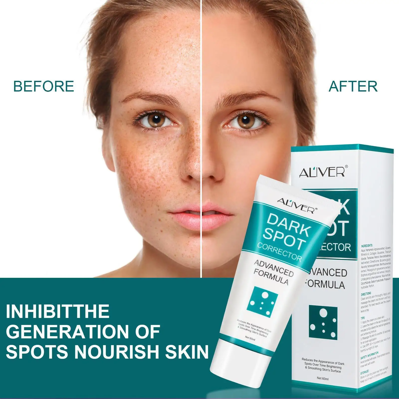 

60ML Whitening Freckle Cream Face Melasma Remover Dark Skin Repair Brightening Remove Effective Anti-Aging Moisturizing Spo G9X0