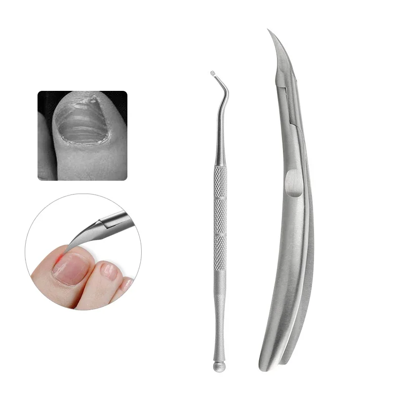 

Paronychia Improved Stainless Steel Nail Clipper Trimmer Ingrown Pedicure Care Professional Cutter Nipper Feet Toenail Tools set