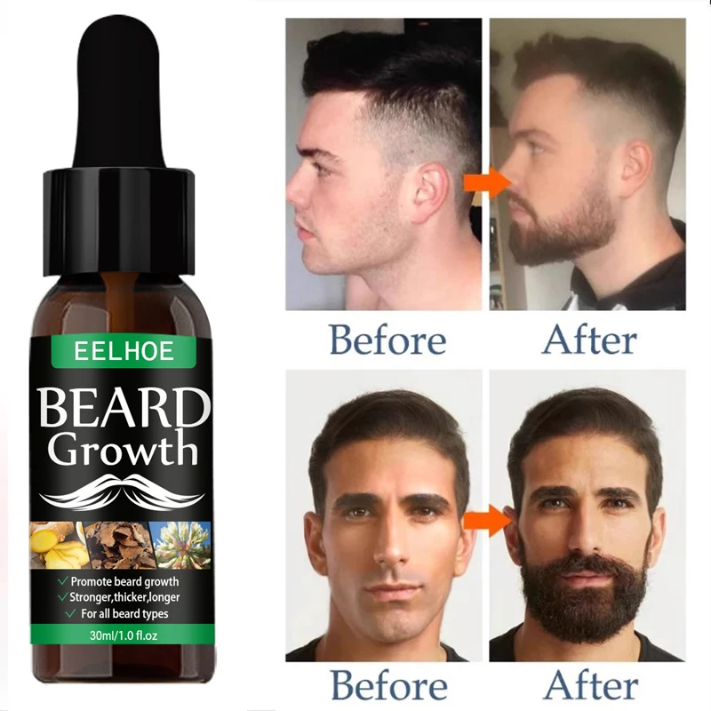 

30ml Beard Growth Oil Ginger Beard Hair Growth Essential Oil Anti Hair Loss Product Moustache Regrowth Men Beard Nourishing Oil