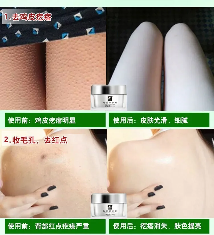 Крем для кожи курицы восстановления волос вокруг тела удаления гусиных ударов