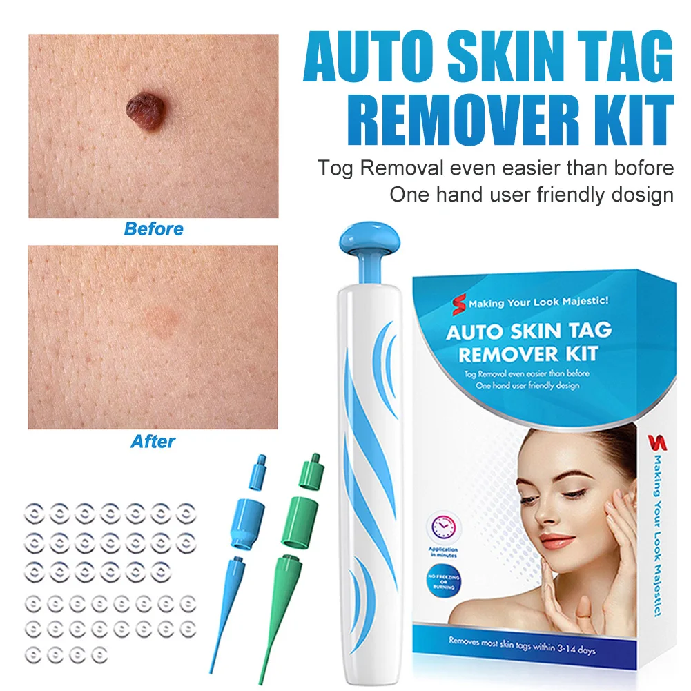 

Painless Auto Skin Tag Remover Kit 2 In1 For 2-8mm Skin Tags Painless Wart Mole Corn Remover Device Face Body Beauty Tools