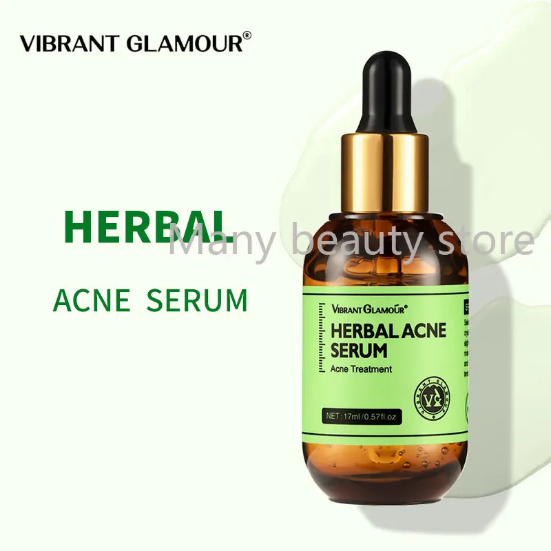 

Herbal Acne Serum 17ml Acne-Treatment Oil-Control Brighten Nourish Whitening Shrink Pores Remove Scars Marks Skin Care Product