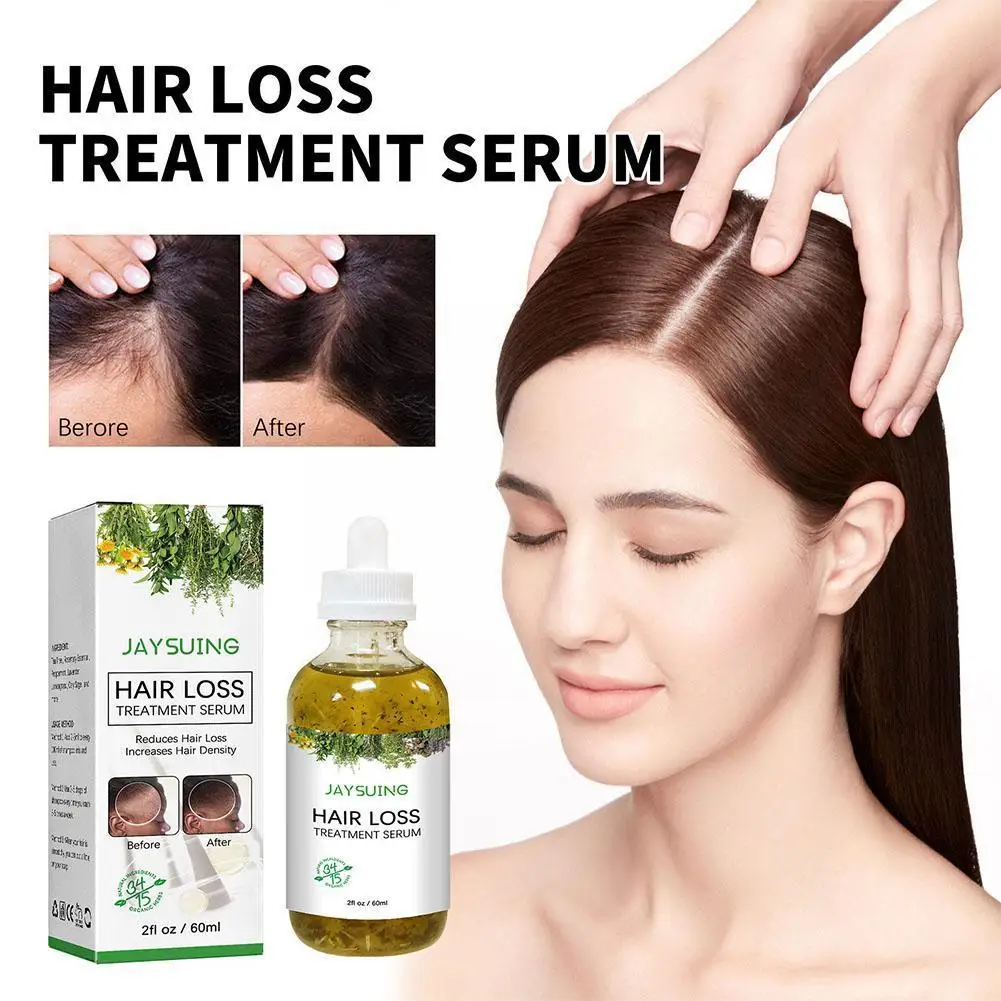 

Шампунь против выпадения волос, против зуда, против перхоти, утолщенная сыворотка, контроль роста, эссенция, корневое масло для кожи головы F...