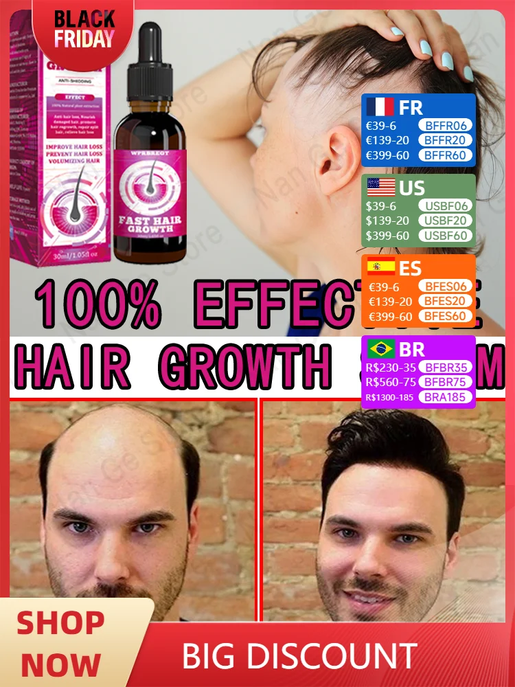 Массаж и расслабляет кожу головы для снятия стресса выпадения волос.