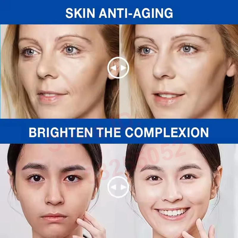 Фото Набор из 5 флаконов Hyaluronic Acid SkinBooster с PDRN, ниацинамидом и глутатионом для увлажнения и ухода за кожей, подходит для салонов красоты №4