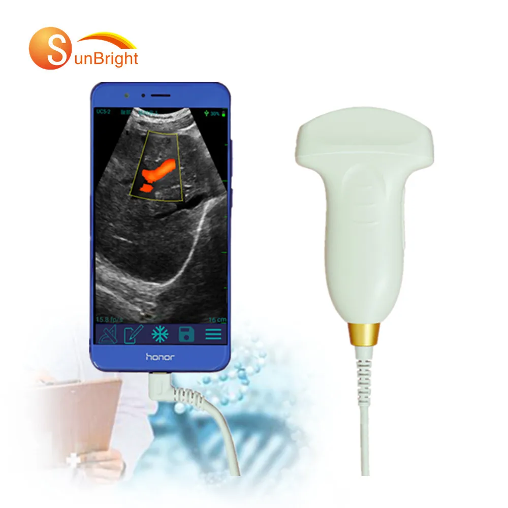 

Hnadheld Design USB Ultrasound Probe PW 128 Element Color Doppler Convex Probe SUN-D1