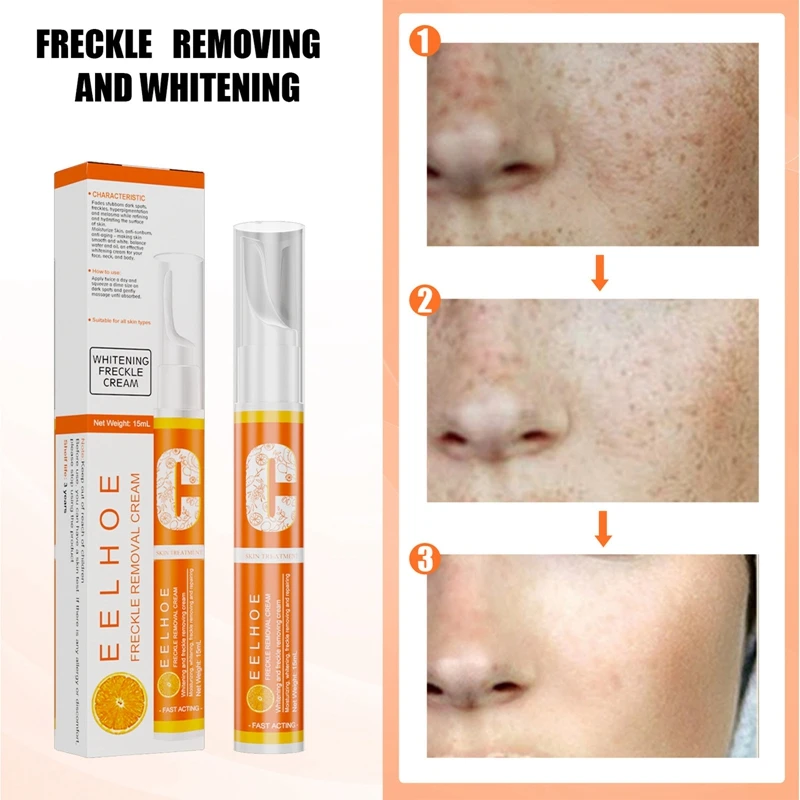 

VC Freckle Dark Spots Cream Pen Remove Freckle Pigmented Melanin Spots Brighten Face Care Instant Blemish Removal Gel Skin Care