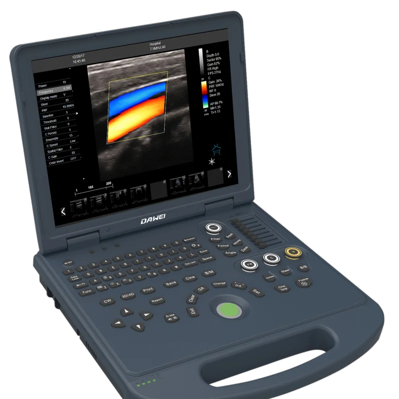 

Full-digital Portable Ultrasound Machine Color Doppler Ultrasonic Diagnostic System