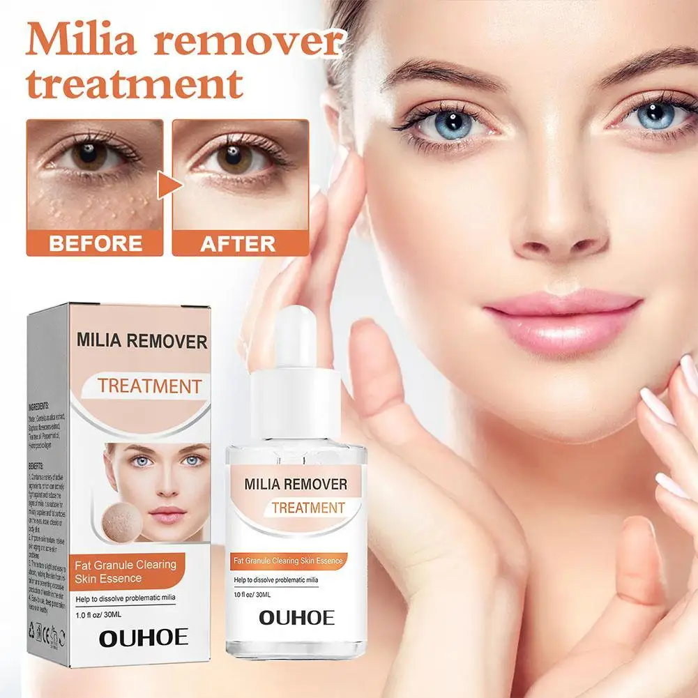 

30ml Milia Clearing Essence Reduce Acne Fat Granule Skin Clearing Serum Anti Aging Anti Acne Serum Skin Care