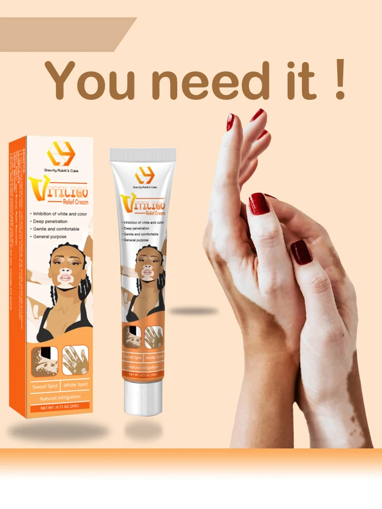 

Vitiligo treatment cream Vitiligo derma relief Skin treatment soothing White Spot Removal vitiligo ointment Eliminate pigment