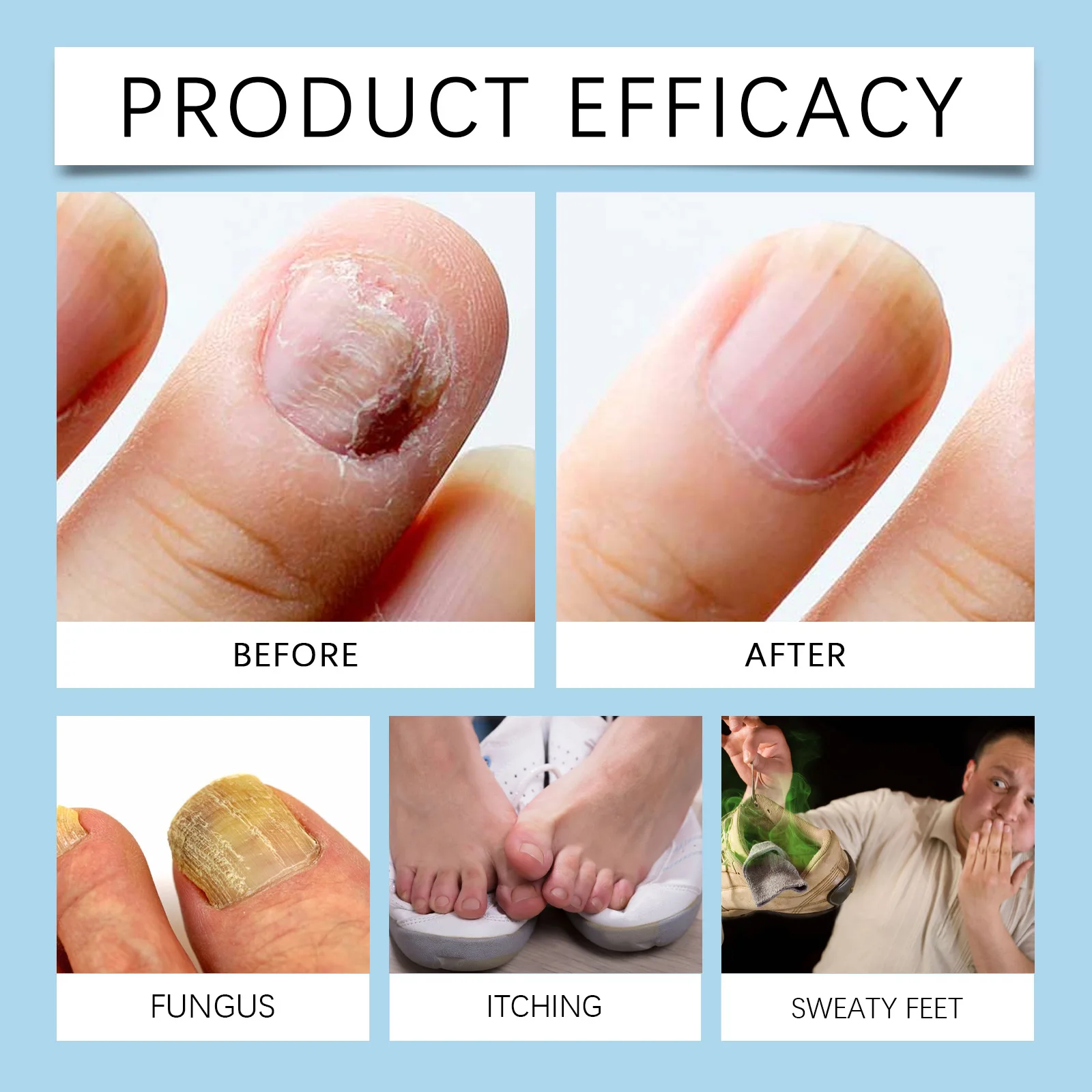 Оnychomycosis удаление рук ног ремонт уход за ногтями сыворотка для лечения грибка