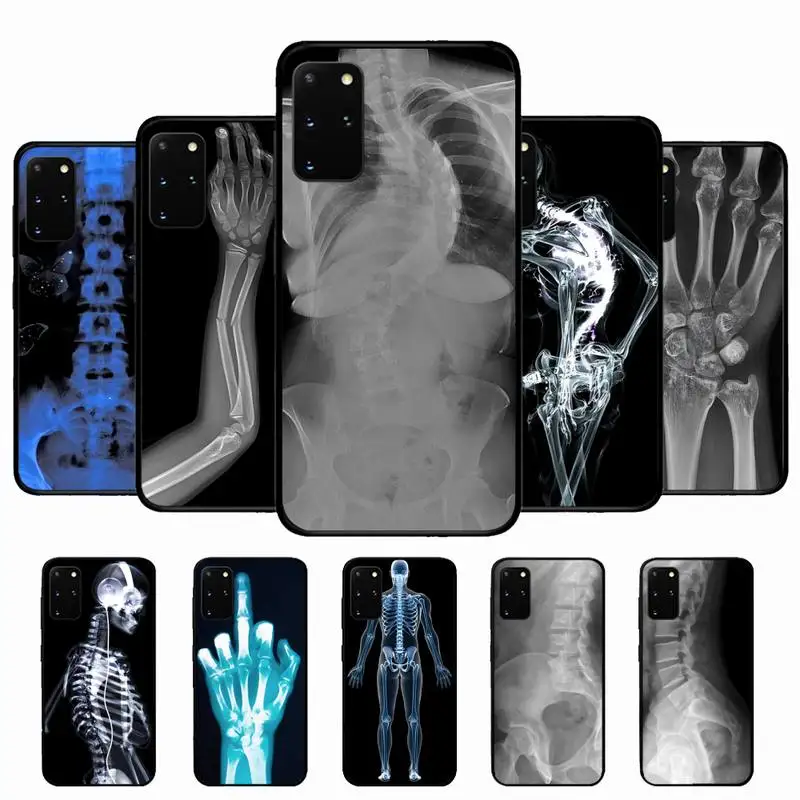 

Radiological human organs Skeleton skull Phone Case for Samsung S10 21 20 9 8 plus lite S20 UlTRA 7edge