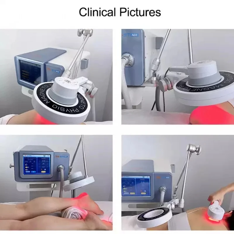 Emtt Physio Магнитотерапия Магнитотерапия Облегчение боли PEMF Спортивная терапия травм Магнитотерапия Физиотерапевтический аппарат (art.: 3920d49010ba2) - 3920d49010ba2