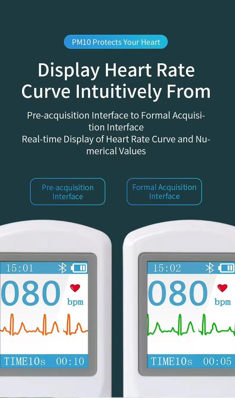 Монитор электрокардиограммы Bluetooth портативный динамический электрокардиограф