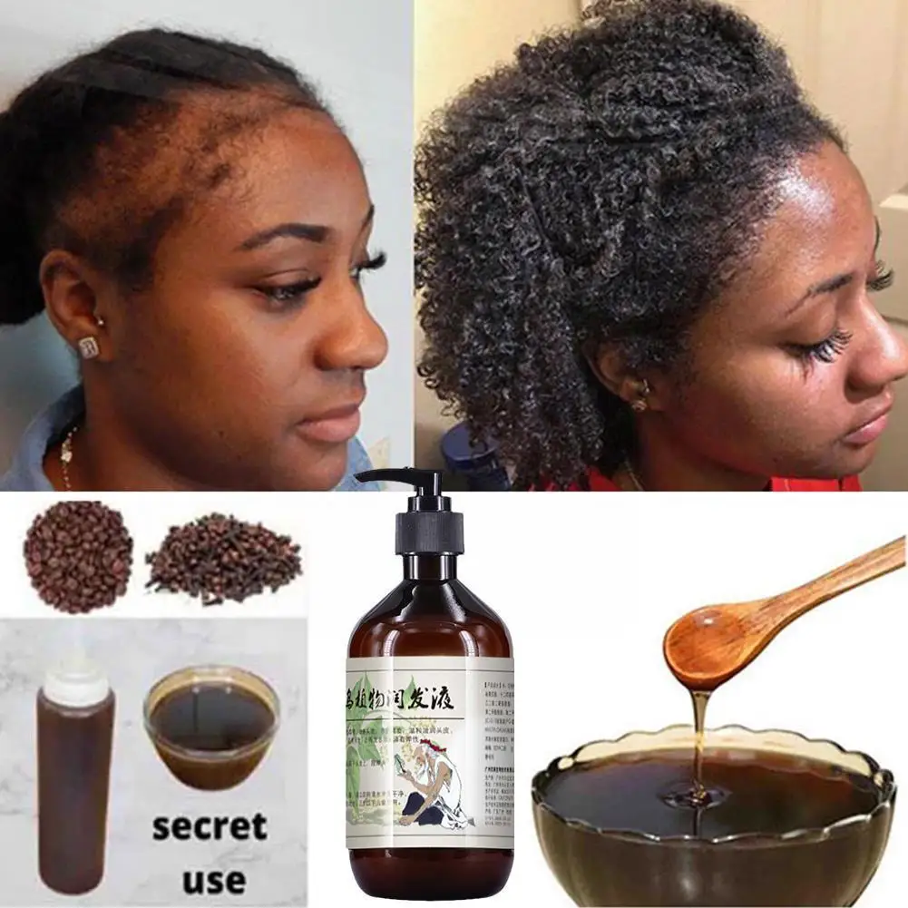 

300 мл многоцветковый шампунь Polygonum, травяное средство для удаления голени, антишампунь 2023, профессиональный шампунь для ухода за волосами M1S2