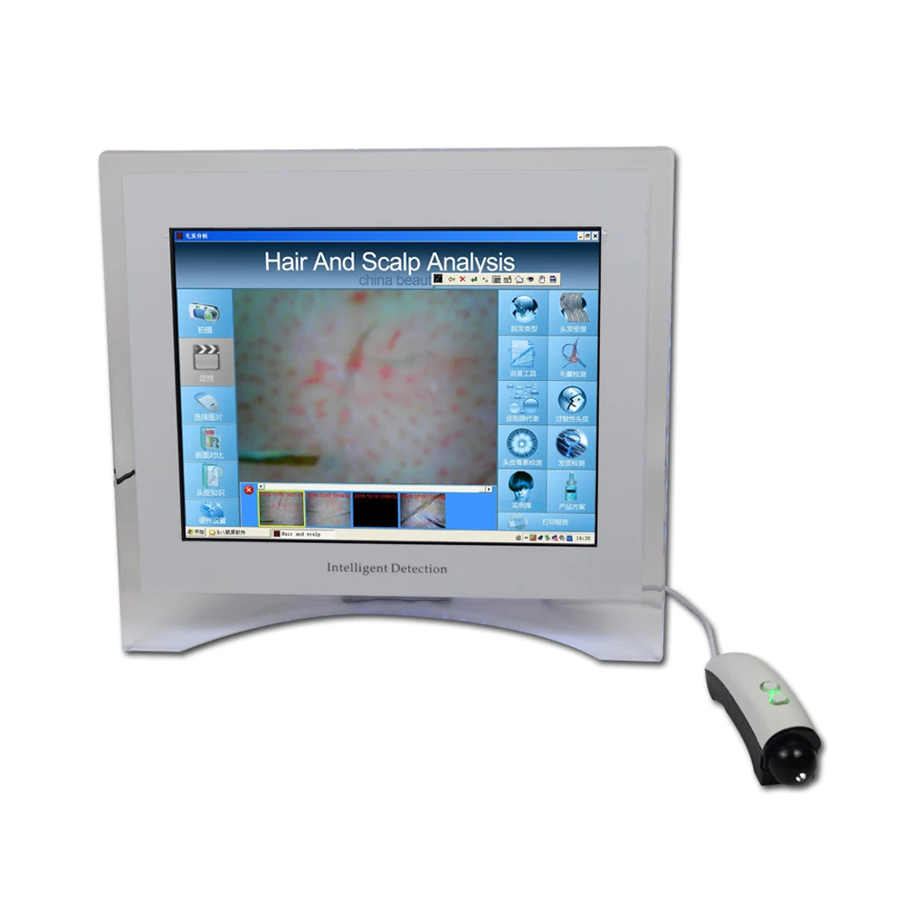 

Professional Hair and Scalp Analyzer Hair Analyzer Intelligent Detector for Beauty Clinic